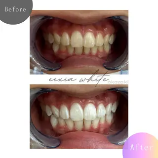 エクシアホワイト岡崎店所属・akari 脱毛・ セルフホワイトニングのその他イメージ