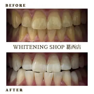 メンズ ホワイトニング ショップ葛西店のその他イメージ