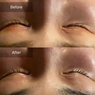 Mandarin Orange所属・毛穴から始める肌メン テマンダリンオレンジのエステ・リラクイメージ