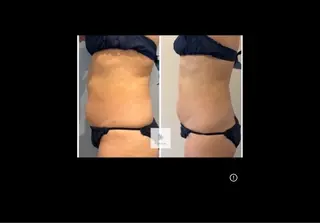 Micell beauty所属・Micell beautyのエステ・リラクイメージ