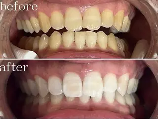 ビューティーサロン　ア・クイーユ所属・ビューティーサロン ア・クイーユのエステ・リラクイメージ