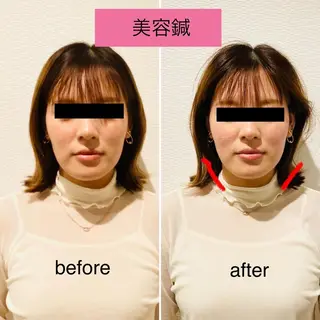 チキバン美容鍼灸整体 サロン心斎橋店のエステ・リラクイメージ