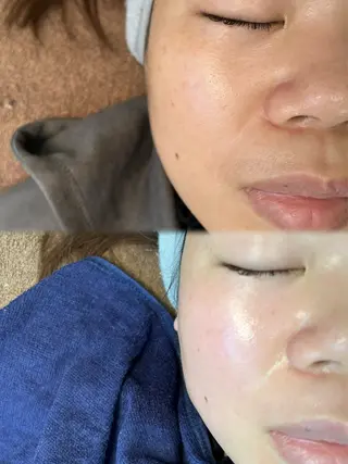 Nalu所属・まつ毛パーマ／脱毛 Naluのエステ・リラクイメージ