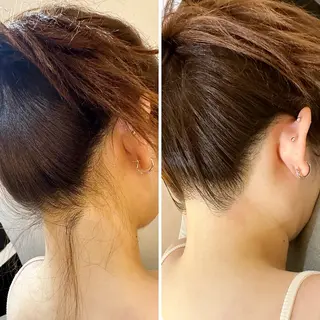 うなじ脱毛/美肌脱毛 LABELのエステ・リラクイメージ