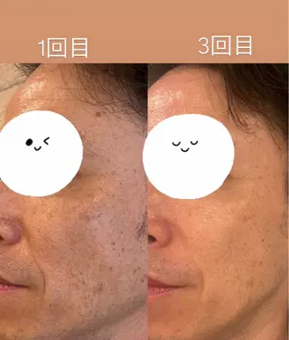 Joo🌿肌育/高岳 アトピー/肌質改善のエステ・リラクイメージ