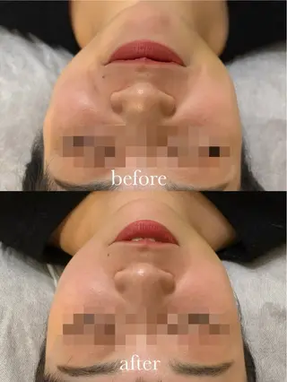 ENNE Lash&Blow by&ERA所属・ENNE🦩小顔整体 師🌿 HINAKOのエステ・リラクイメージ