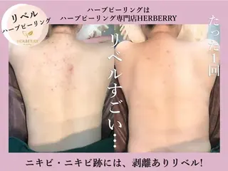 ハーブピーリング専門店HERBERRY難波心斎橋店所属・ハーブピーリング専門 HERBERRY冨永のエステ・リラクイメージ