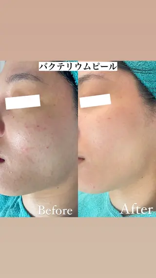 都度払い制脱毛サロンBe Charm所属・Be Charm 山﨑のエステ・リラクイメージ