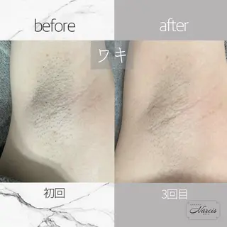 エステサロンNarcis〜ナルシス〜所属・脱毛＆痩身エステ Narcisのエステ・リラクイメージ