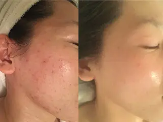 国際認定エステサロン ホワイトカメリアのエステ・リラクイメージ