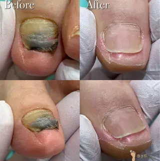 福岡巻き爪補正店 博多店のエステ・リラクイメージ