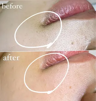 eyelash salon  kirari所属・岩間 優子のマツエク・マツパデザイン