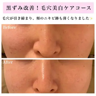 Bellesthe (ベルエステ)のエステ・リラクイメージ