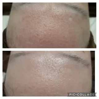 エル ビューティー2のエステ・リラクイメージ