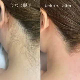 An Blossom所属・An Blossom 脱毛/茅ヶ崎/美咲のエステ・リラクイメージ