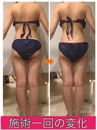 ロング カラー パーマ ヘアアレンジ メンズ キッズ ネイル マツエク・マツパ ‍痩身＆ボディ 結果出し🌟丹野のエステ・リラクイメージ