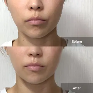 nail RiRi アトレナチュラのエステ・リラクイメージ