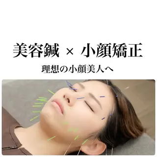 整体×美容鍼灸 鍼灸師Miyanoのエステ・リラクイメージ