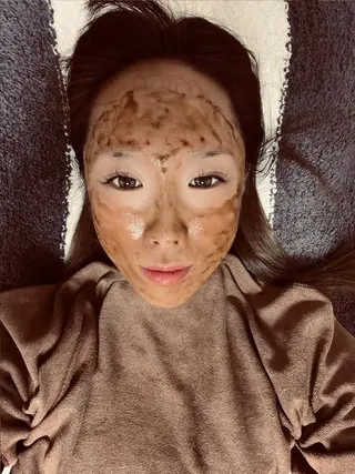 美容鍼灸サロン mahoroba院長のエステ・リラクイメージ