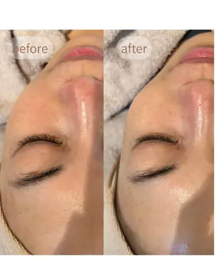 MiEL total beauty salon所属・Rie ×MiELのエステ・リラクイメージ