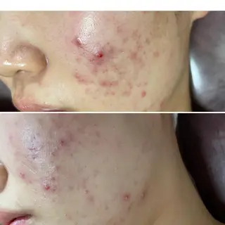 Raj   Pathラージパトゥ所属・ラージ パトゥのエステ・リラクイメージ