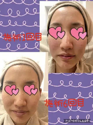 まつ毛パーマ・美肌 ナチュラル　ボーテのマツエク・マツパデザイン