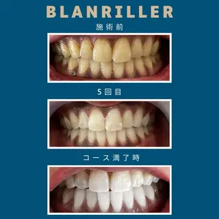 BLANRILLER所属・ホワイトニングサロン ブランリエ阿倍野店のその他イメージ