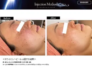 リュー・.ド・ボウテ所属・肌質改善サロン★ リュー・ド・ボウテのエステ・リラクイメージ