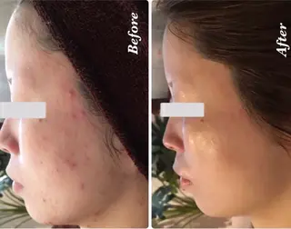 beauty salon    nani所属・ビューティサロン Naniのエステ・リラクイメージ