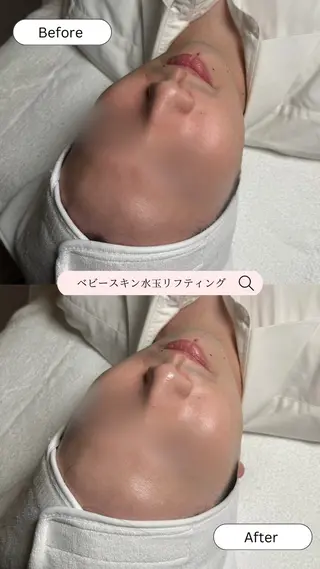 韓国肌管理🫧LDM 🫧Junnaのエステ・リラクイメージ