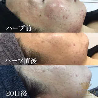 温活未病ケアサロン CoQのエステ・リラクイメージ