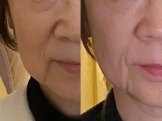 99-KUKU-所属・天神美容鍼99 -KUKU-吉弘萌香のエステ・リラクイメージ