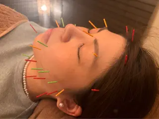 Acupuncture  salon LINOA リノア鍼灸院所属・LINOAヘッドスパ 小顔ケア/逆子ケアのエステ・リラクイメージ