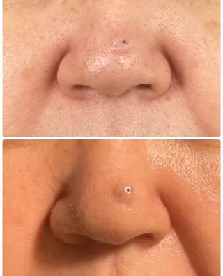 肌質改善🕊️ hirokoのエステ・リラクイメージ