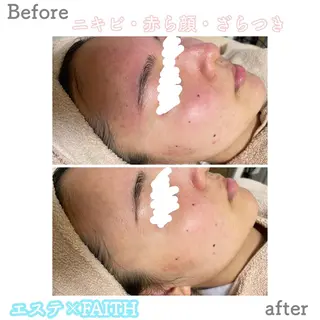 ミディアム カラー パーマ ヘアアレンジ メンズ キッズ ネイル マツエク・マツパ アイブロウ ニキビ&跡改善サロン オーナー光木のエステ・リラクイメージ