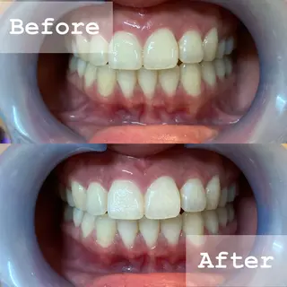 LBSホワイトニング 新宿店💝公式のその他イメージ