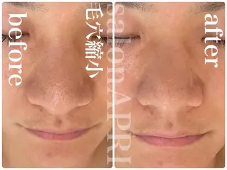 パーソナル肌質改善 🦋APRI🅿️有のエステ・リラクイメージ