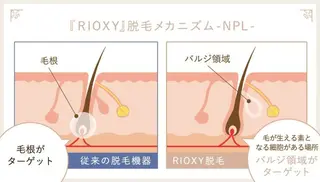 Le cherien (ルシェリア)所属・Ri saのエステ・リラクイメージ