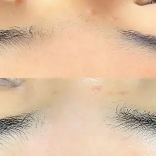 Hit. シュガーリング豊橋のエステ・リラクイメージ