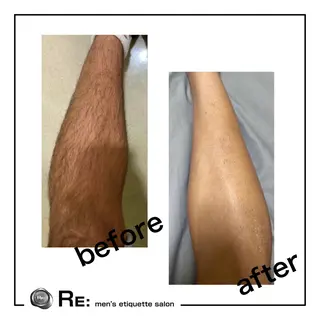 【都度払い脱毛】 RE: 桜木町店のエステ・リラクイメージ