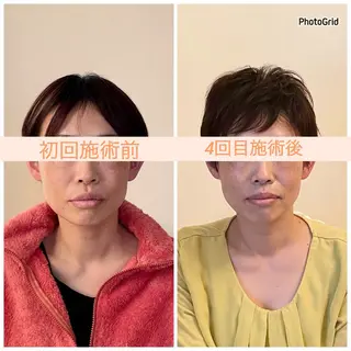 小顔矯正サロン　ReFace Fusae（リフェイスフサエ）所属・小顔矯正サロン リフェイスフサエのエステ・リラクイメージ