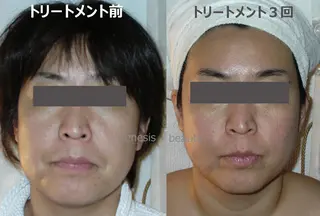 genese beauteのエステ・リラクイメージ