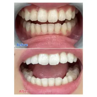 MBEAUTYSALON 千葉店・京成大久保所属・Melty 輝のその他イメージ