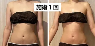 痩身&小顔矯正専門店 Re:Livesのエステ・リラクイメージ