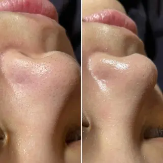 SESUNNY セサニー SEIRAのマツエク・マツパデザイン