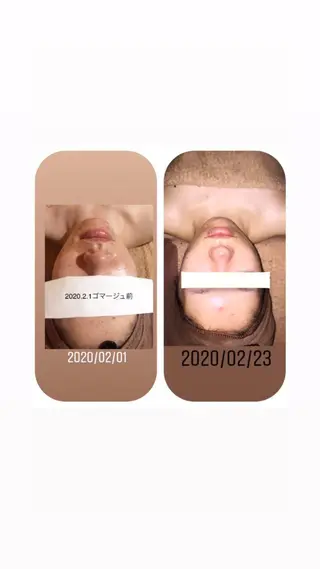 【足圧】鬼👹リンパ 身体整うサロンのエステ・リラクイメージ