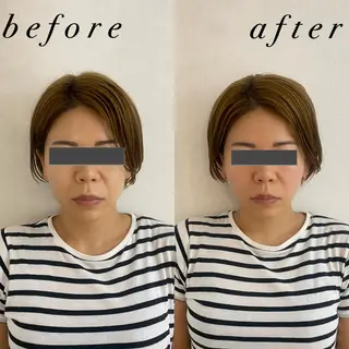 うなじ脱毛/美肌脱毛 LABELのエステ・リラクイメージ