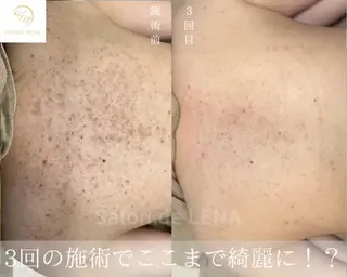 Grandir所属・ハーブピーリング専門 グランディール　武内のエステ・リラクイメージ