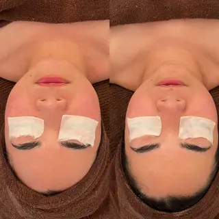 毛穴ケア/毛穴診断/ 毛穴洗浄〔心斎橋〕のエステ・リラクイメージ