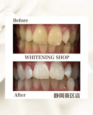 ホワイトニングショップ静岡葵区店所属・ホワイトニング ショップ葵区静岡駅店のその他イメージ
